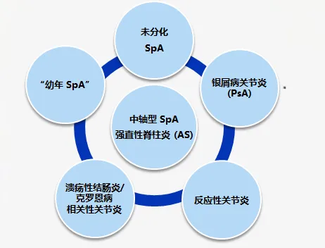 克罗恩诊断与鉴别诊断_罗克恩病怎么确诊_克罗恩病的鉴别诊断