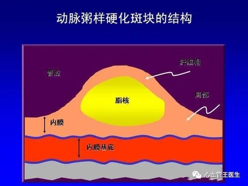 冠心病护理要点_护理冠心病患者的注意事项_护理冠心病要点有哪些