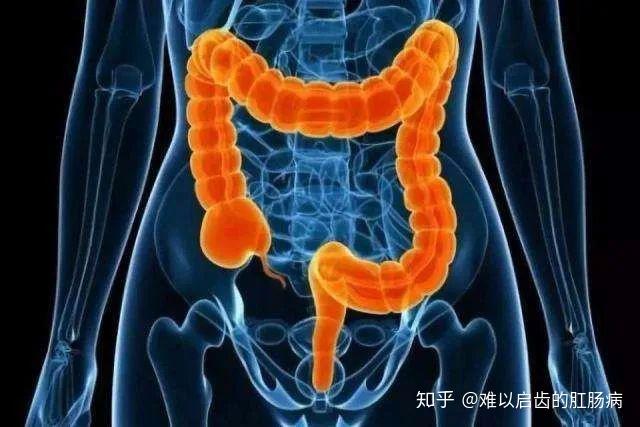 肛门粘液失禁怎么回事_肛门失禁 粘液_肛门有粘液渗出