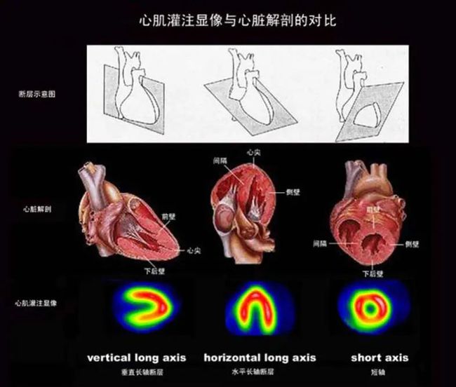 冠心病诊断病历书写顺序_冠心病病例_冠心病的病例如何书写