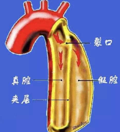 深呼吸后背疼是肺癌吗-深呼吸后背疼得要命，网上众说纷纭，我该如何是好？