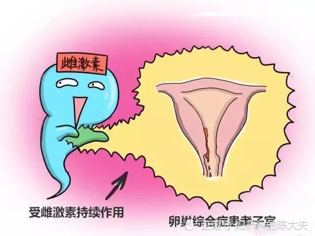 卵巢多囊生了孩子能生二胎吗_有多囊卵巢能生小孩吗_卵巢多囊生孩子会好吗