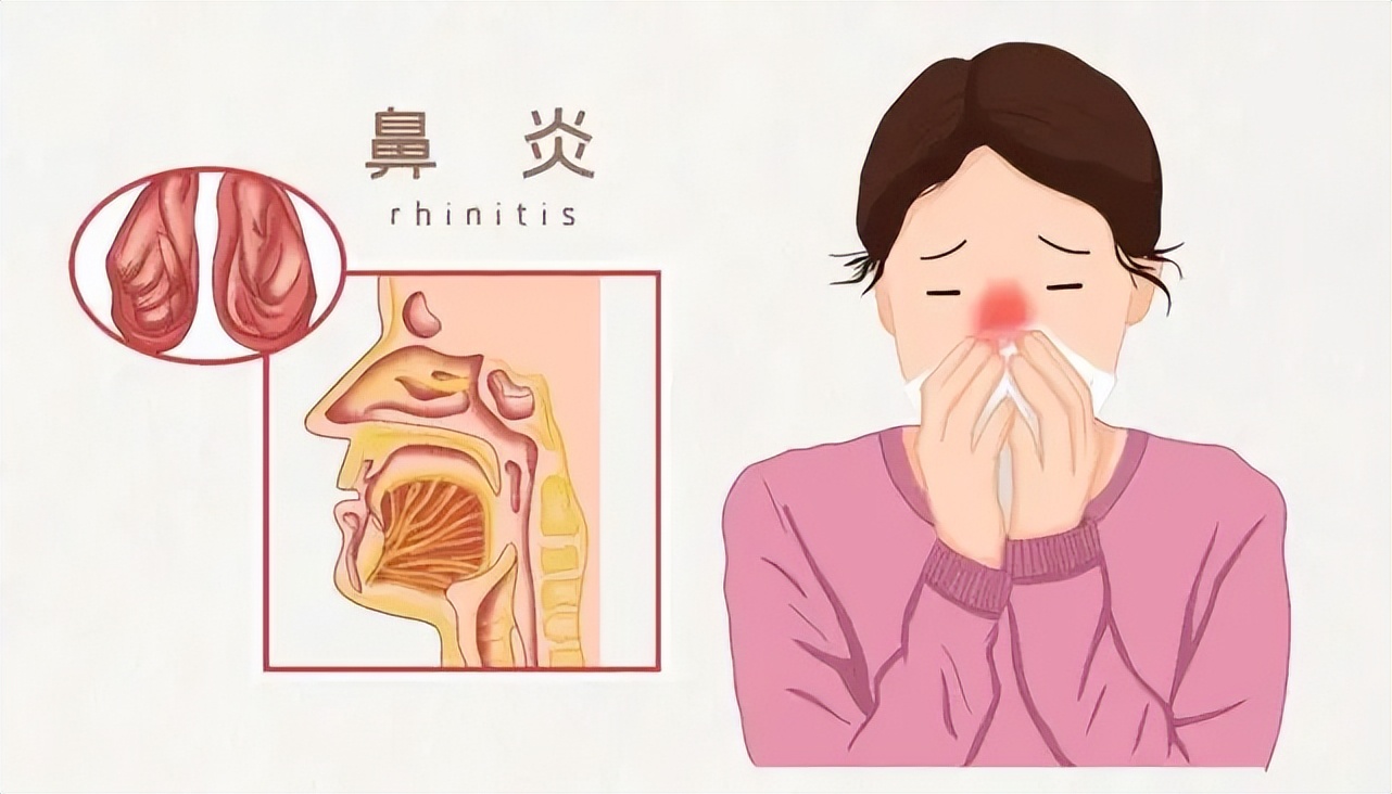 肺早期症状结核是什么意思_肺结核早期症状是什么_肺早期症状结核是肺癌吗