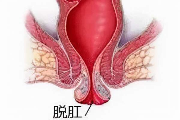 肛门病因失禁症状_肛门失禁病因_肛门病因失禁怎么治疗