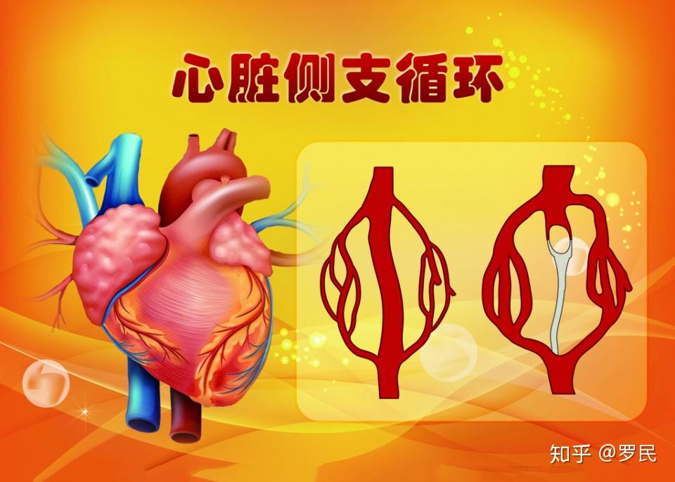 介入治疗心梗过程_心肌梗死介入后的并发症_心梗介入治疗并发症