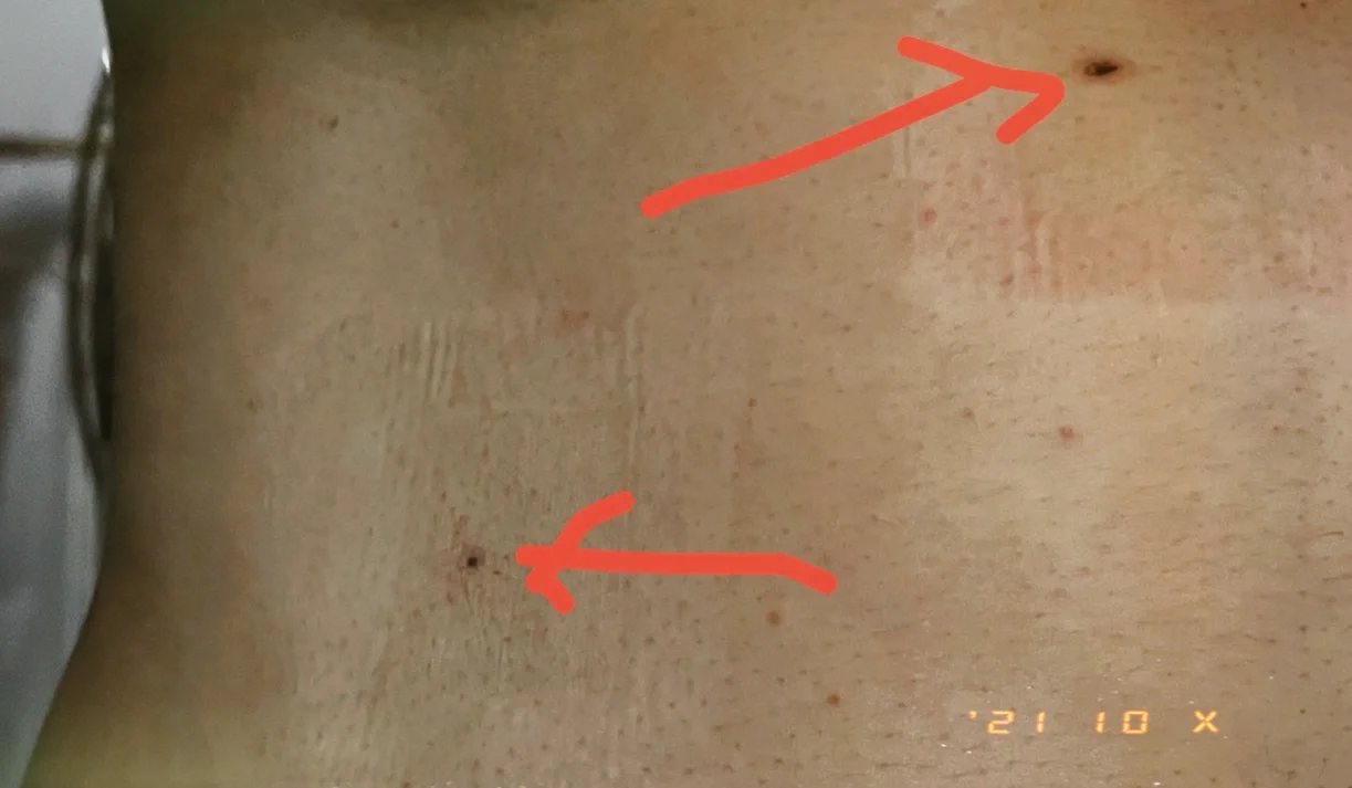 硬盘烧毁数据能恢复吗_硬盘烧坏数据恢复_硬盘烧了恢复数据要多少钱