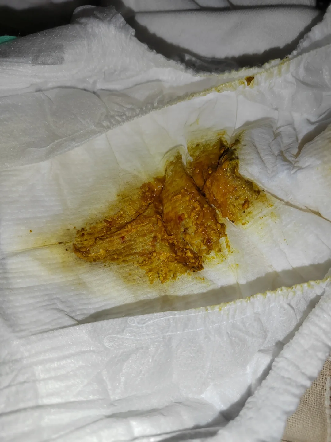 拉屎出鲜血多_拉鲜血大便好多出血_拉大便拉出好多鲜血