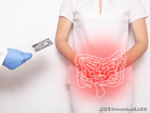 克罗恩的护理查房_克罗恩的护理诊断_克罗恩病护理要点