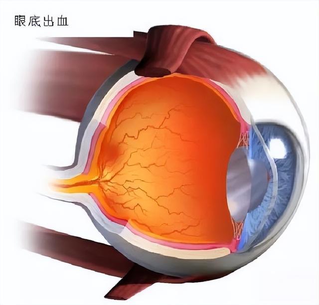 眼球回事白发蓝是怎么回事_白眼球发蓝是怎么回事_眼球白发蓝是什么原因