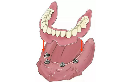注册机如何激活cad_recover4all注册机_注册机械租赁公司都需要什么