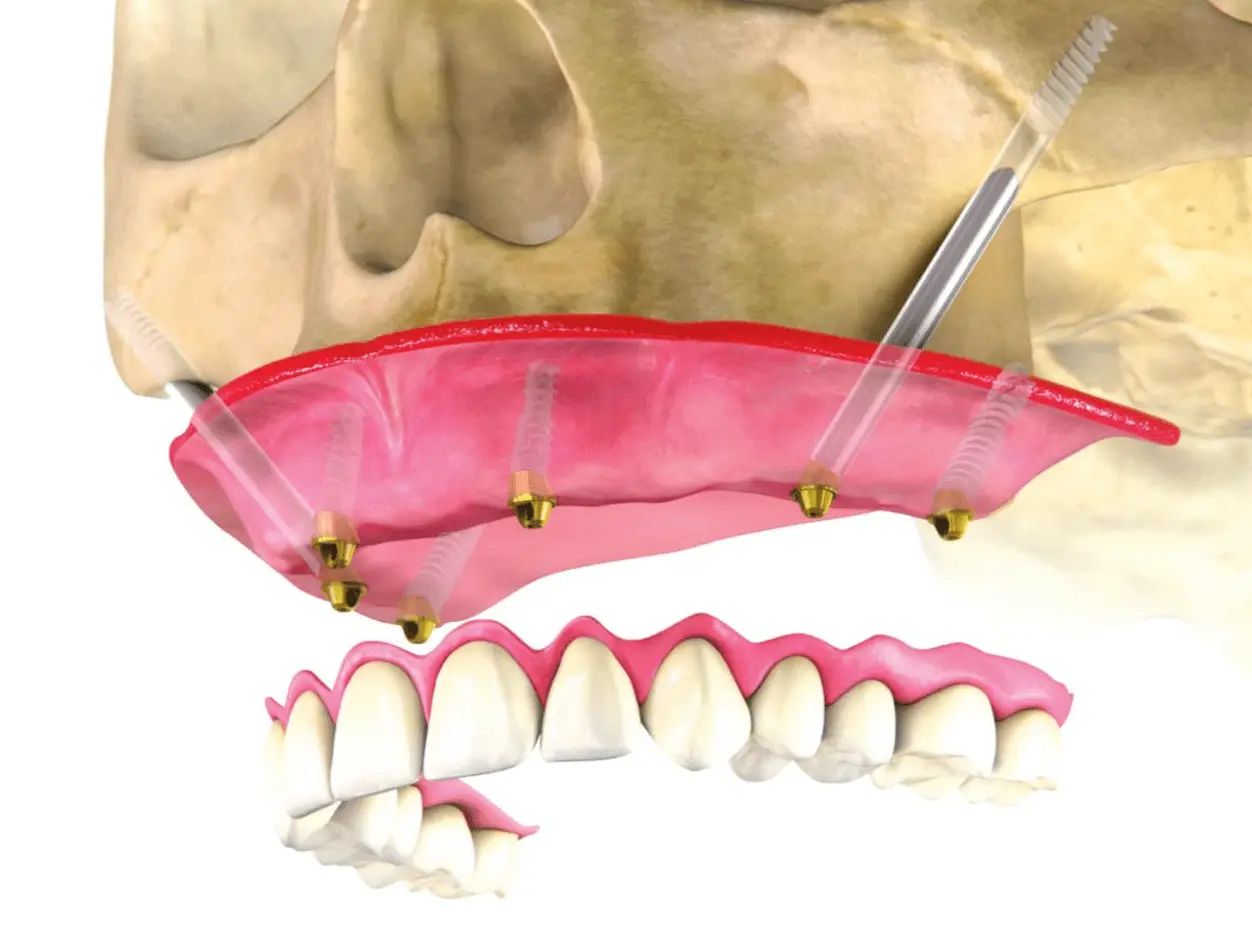 注册机如何激活cad_注册机械租赁公司都需要什么_recover4all注册机
