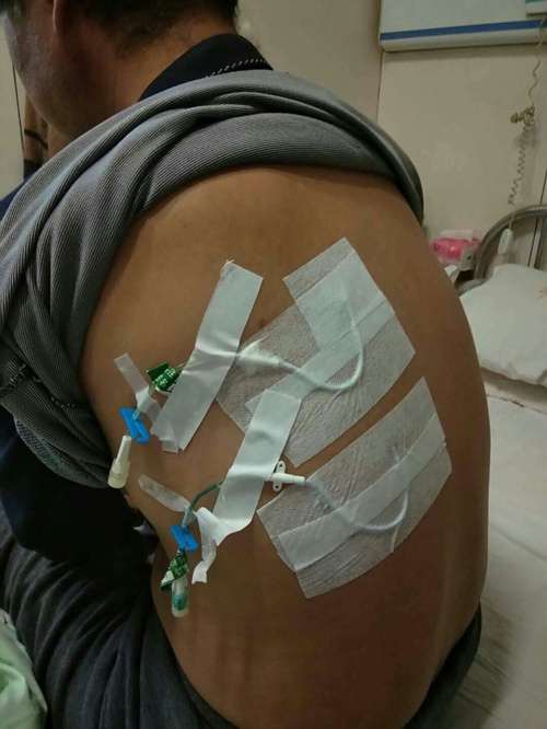 前胸后背疼恶心干呕_前胸后背疼恶心干呕_恶心后背疼前胸干呕什么原因