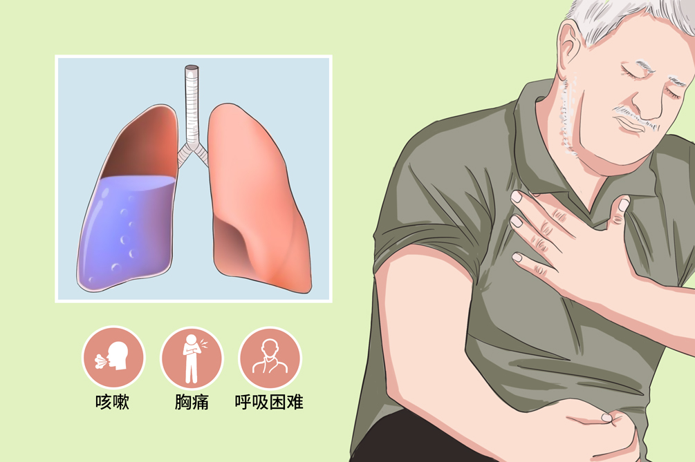 气胸严重吗-气胸危害大，突然呼吸困难可致严重并发症，需警惕