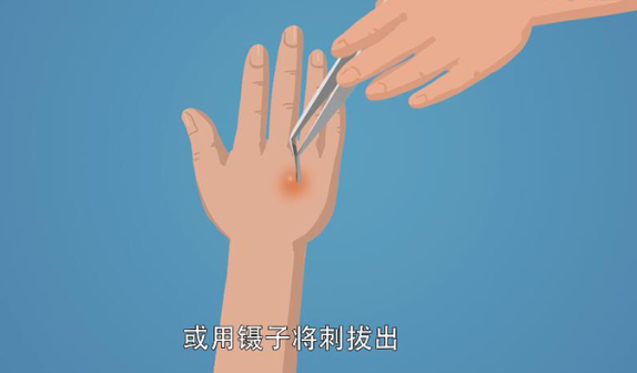 被地雷蜜蜂蛰后头疼怎么办-被地雷蜜蜂蛰后头疼难忍，这些方法或许能帮你缓解