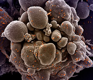 呼吸道合胞病毒的英文_呼吸道合胞病毒英文_呼吸合胞病毒表现