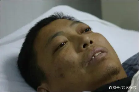 后背疼呼吸肺癌是怎么回事_深呼吸后背疼是肺癌吗_后背疼呼吸肺癌是什么原因