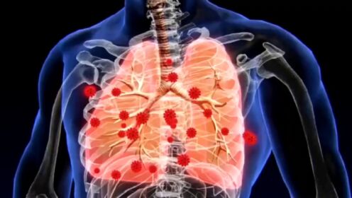 出现呼吸衰竭的原因是_呼吸衰竭定义及可能原因_造成呼吸衰竭的主要原因是