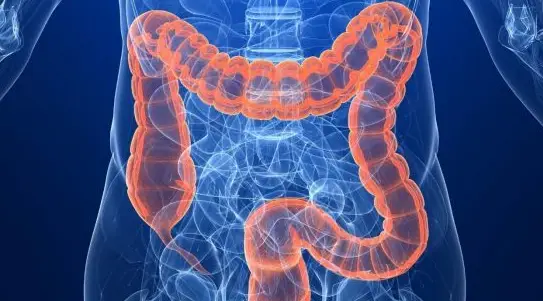 小肠克罗恩病能治好吗_小肠克罗恩病吃什么药_小肠克罗恩治疗