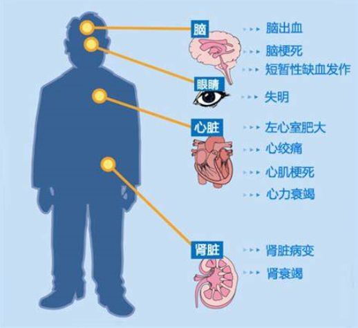 心悸是什么感觉_心悸是怎么意思_什么是心悸