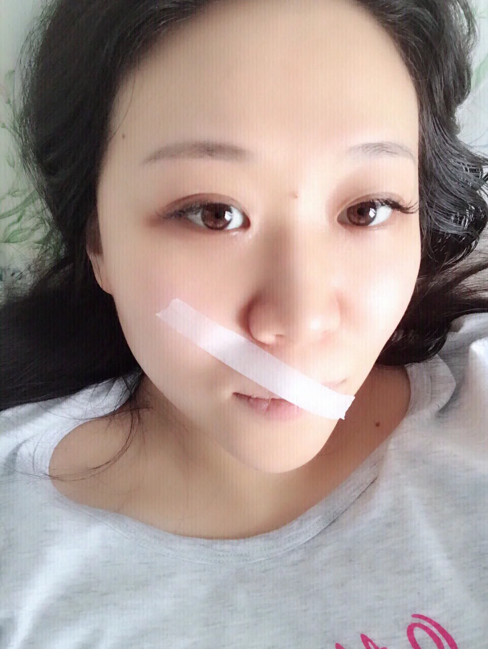 肛瘘手术后换药要多长时间_肛瘘手术换药多久_肛瘘手术后换药多久拿掉纱布