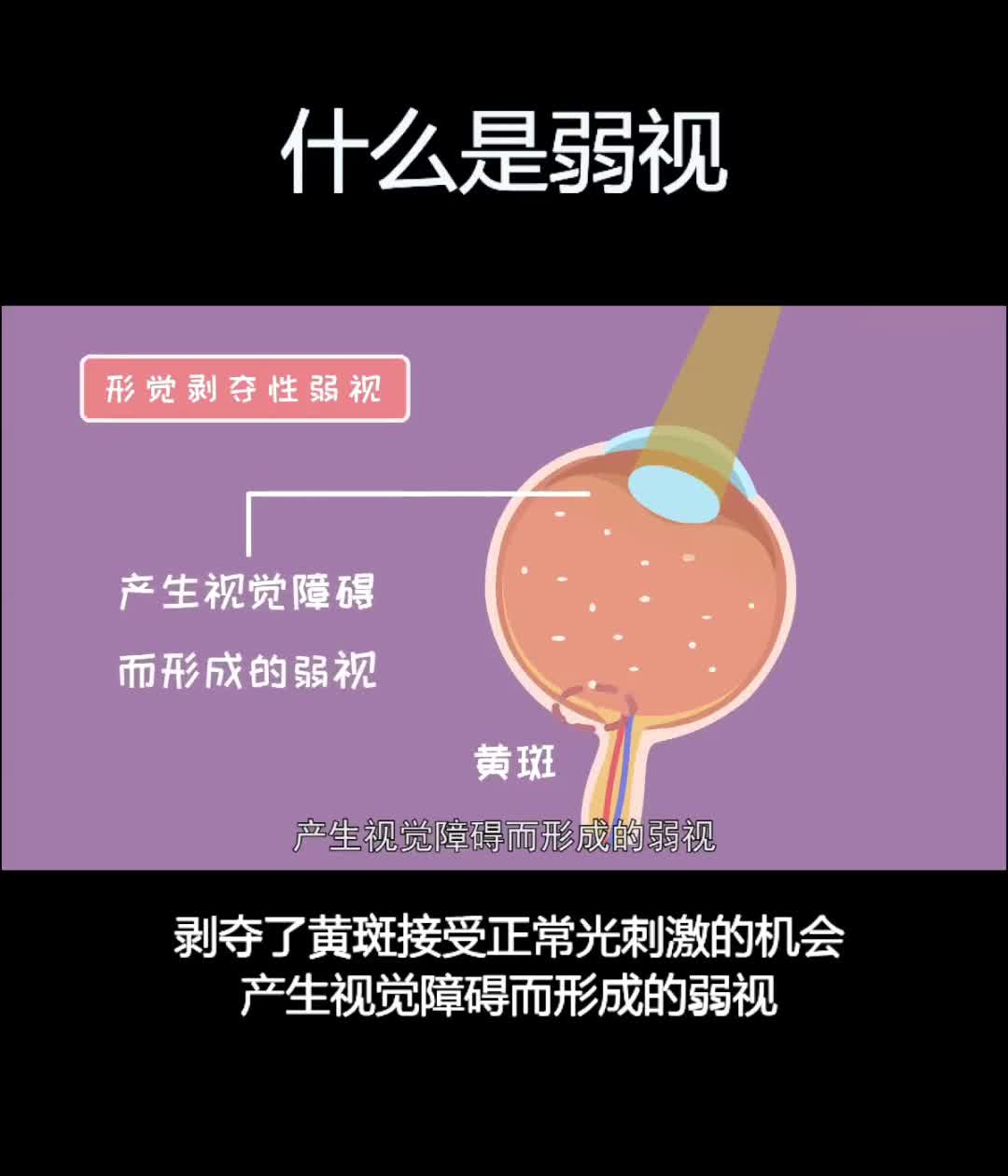 三级肺结核能活多久_三级肺结核是什么意思_三级肺结核严重吗