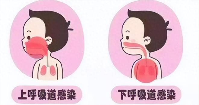 儿童肺炎的治疗方法_肺炎儿童怎么治疗_肺炎治疗儿童方法有几种