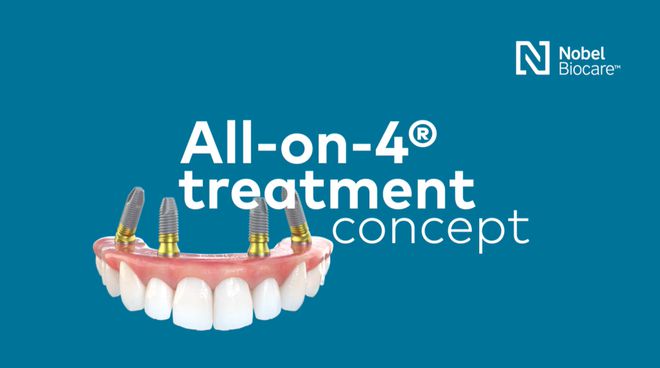 recover4all4.1注册码-Recover4all4.1 注册码，真的存在吗？寻找它的艰辛历程
