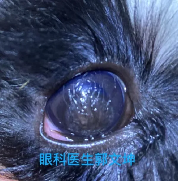 眼球回事白发蓝是怎么回事_白眼球发蓝是怎么回事_眼球白发蓝是什么原因