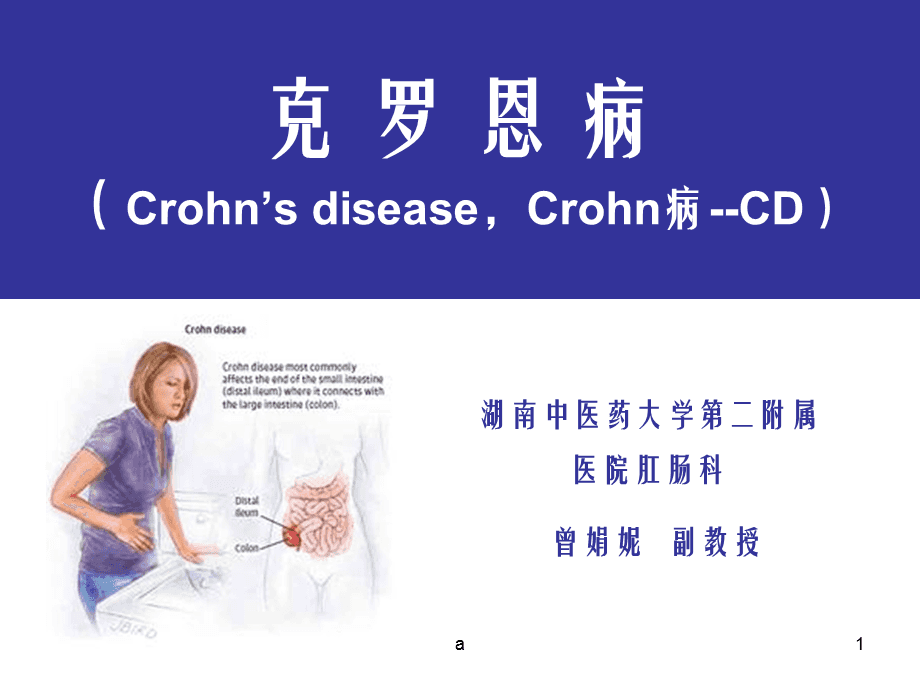 罗克恩病能治好吗_罗克罗恩病_克罗恩病治疗