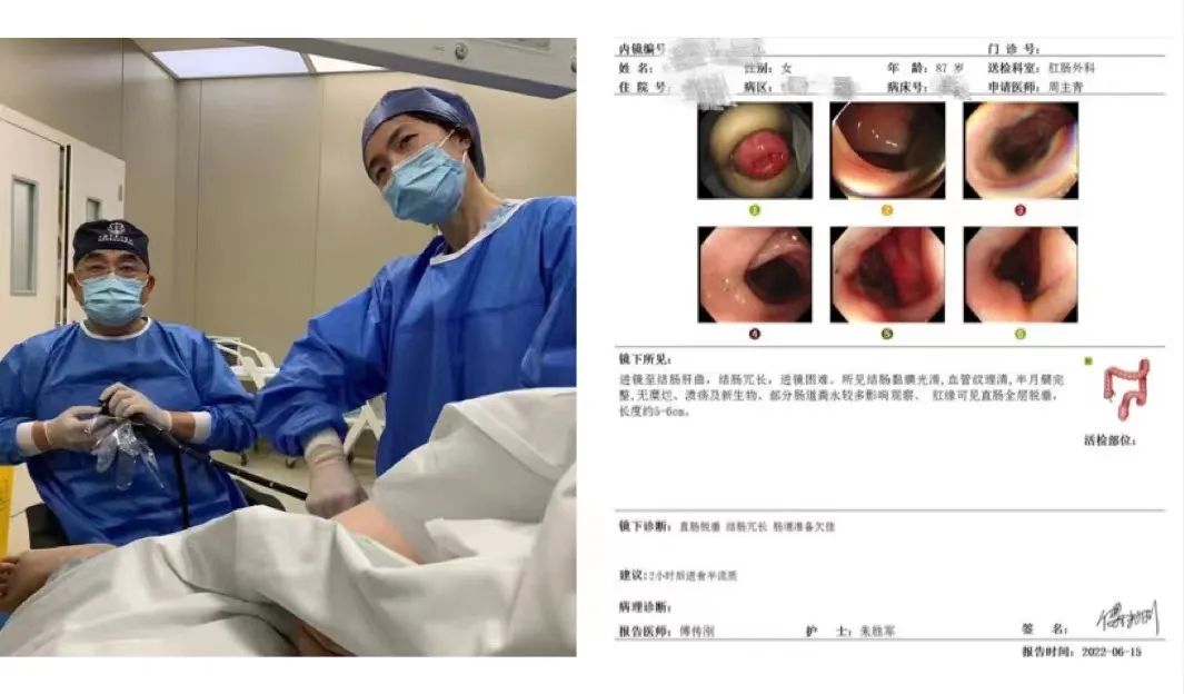 肛门失禁图片-揭开肛门失禁的隐秘面纱，感受不为人知的痛