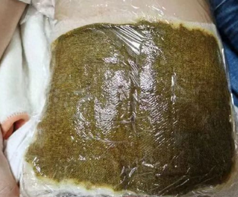儿童肺炎治疗过程中会加重吗_儿童肺炎治疗过程中会加重吗_小孩肺炎加重会演变成什么
