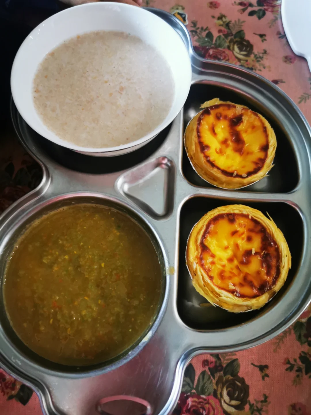 肛瘘手术后的饮食_饮食手术肛瘘后吃什么好_饮食手术肛瘘后注意事项
