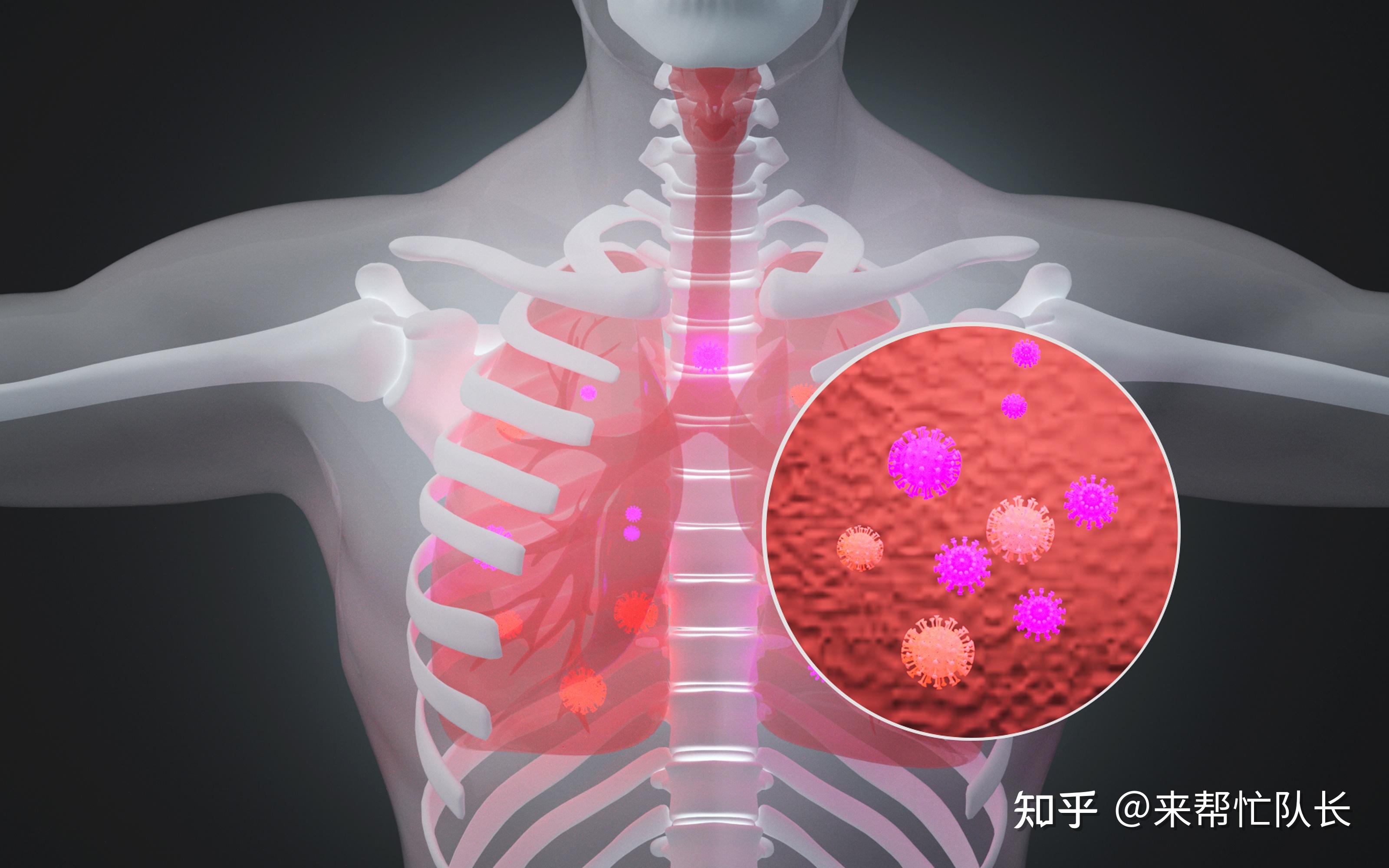 感染肺结核早期症状-肺结核早期症状你知多少？咳嗽、乏力、低烧，警惕这些无声的阴影