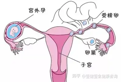 mapinfo安装报错_怎么安装mapinfo_mapinfo无法安装