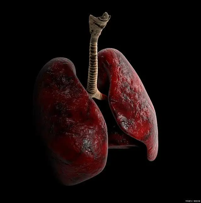 肺炎咳嗽白痰好还是黄痰好_肺炎咳白痰_肺炎咳嗽有白痰怎么回事