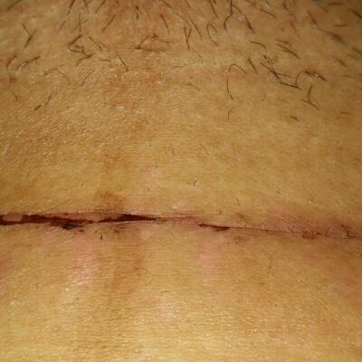 产妇感冒咳嗽可以喂母乳吗_产后感冒咳嗽可以喂奶吗_剖腹产后感冒咳嗽怎么办