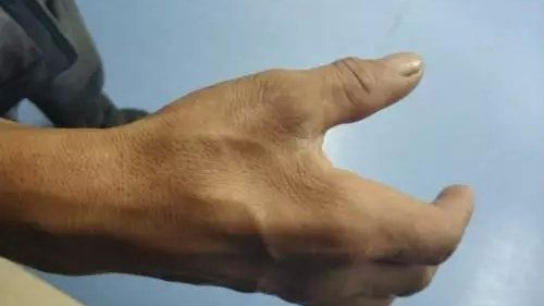 胃肠病论坛_肠胃病专家在线咨询_胃肠病800问