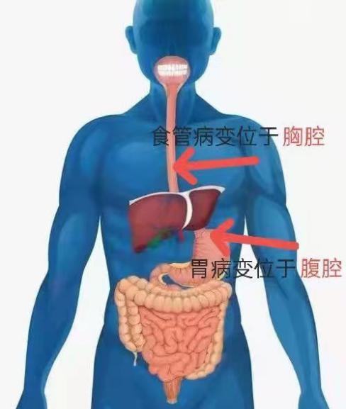 西安胃病有名的老中医_西安胃病论坛_西安胃病专家