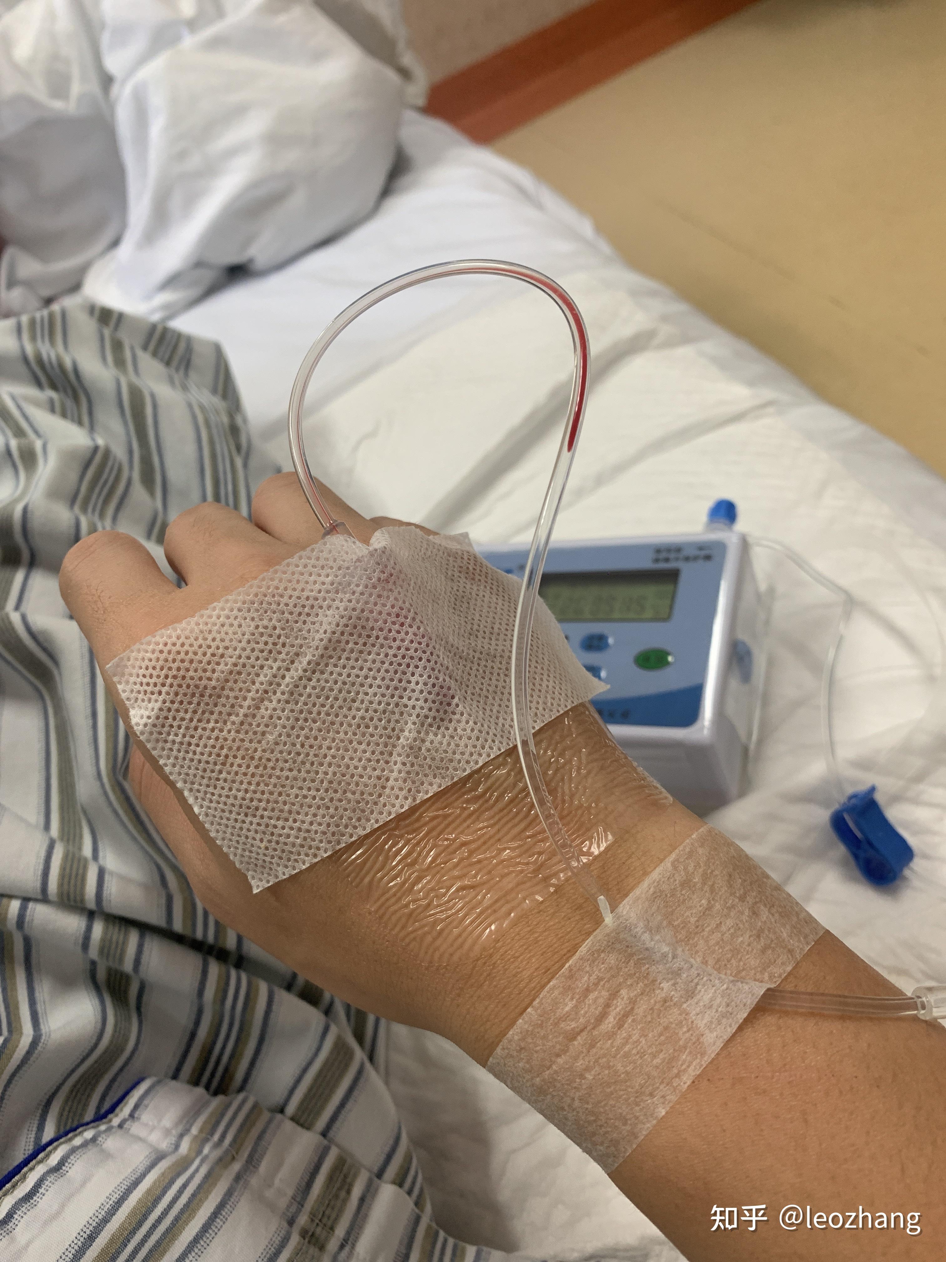 做肛瘘手术一般要多长时间扩肛_肛瘘手术后多长时间才能扩肛_肛瘘手术后多久扩肛门