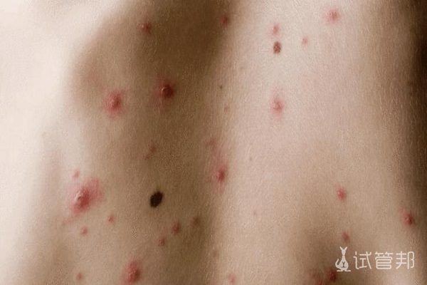 男性疾病的主要症状有哪些_男性疾病有哪些症状_男性疾病症状图片大全