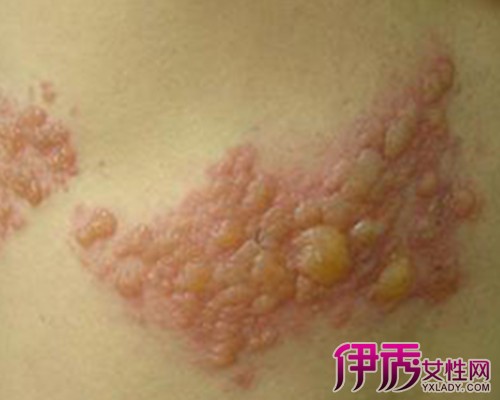 男性疾病症状图片大全_男性疾病的主要症状有哪些_男性疾病有哪些症状