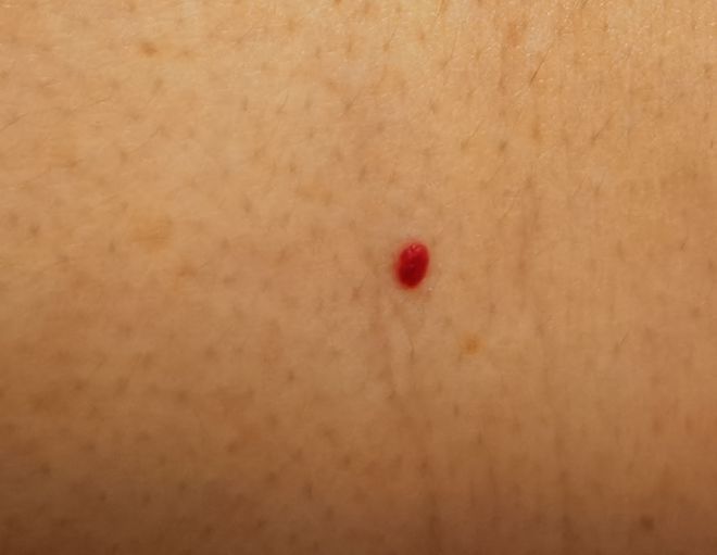 男性疾病症状图片大全_男性疾病有哪些症状_男性疾病的主要症状有哪些