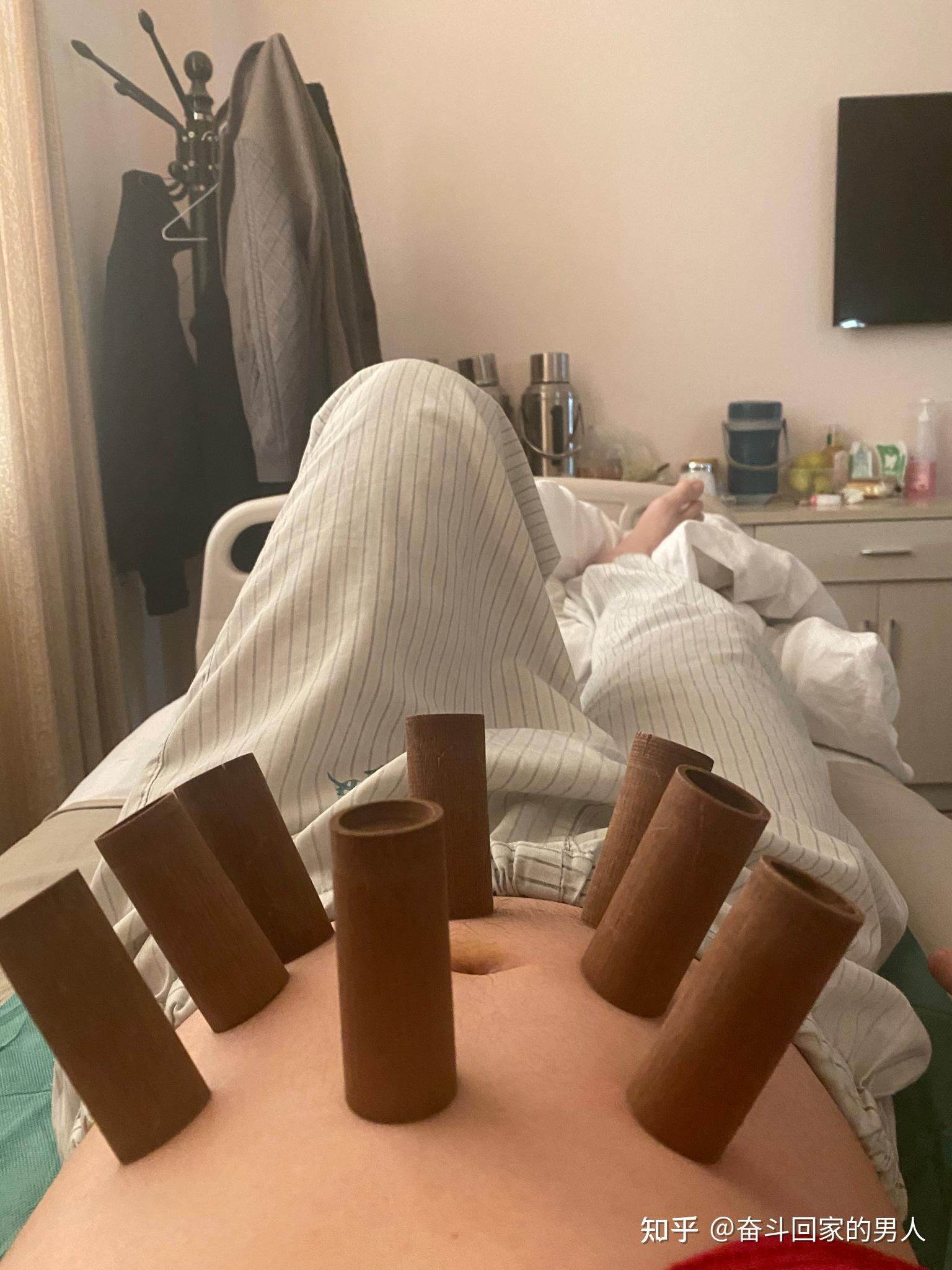 肛瘘手术多长时间能过性生活_肛瘘手术后多久可以性l生活_肛瘘手术一般多久可以坐
