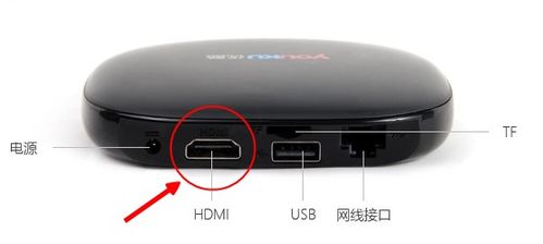 安卓电视没有系统设置,轻松解锁智能电视新功能